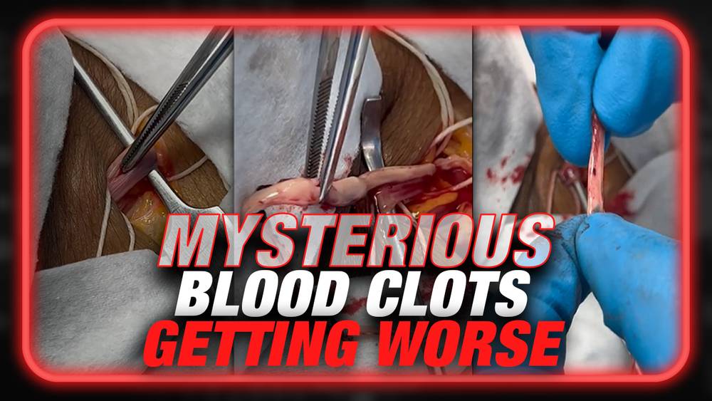 Funeral Home Director Warns Mysterious Blood Clots Getting Worse